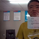 In 10 years, a Chinese youth turned into an old man