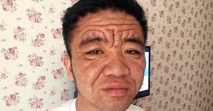 In 10 years, a Chinese youth turned into an old man