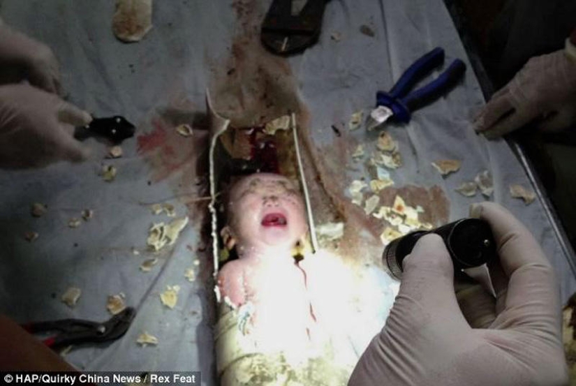 In China, a newborn was rescued after being flushed down the toilet