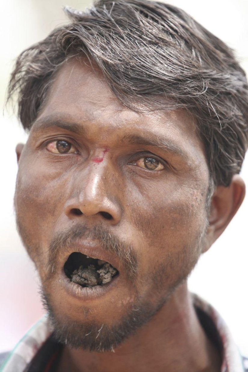 Indian man eats bricks and stones for 20 years