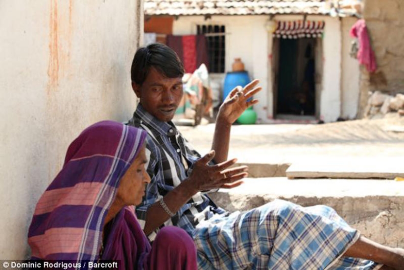 Indian man eats bricks and stones for 20 years