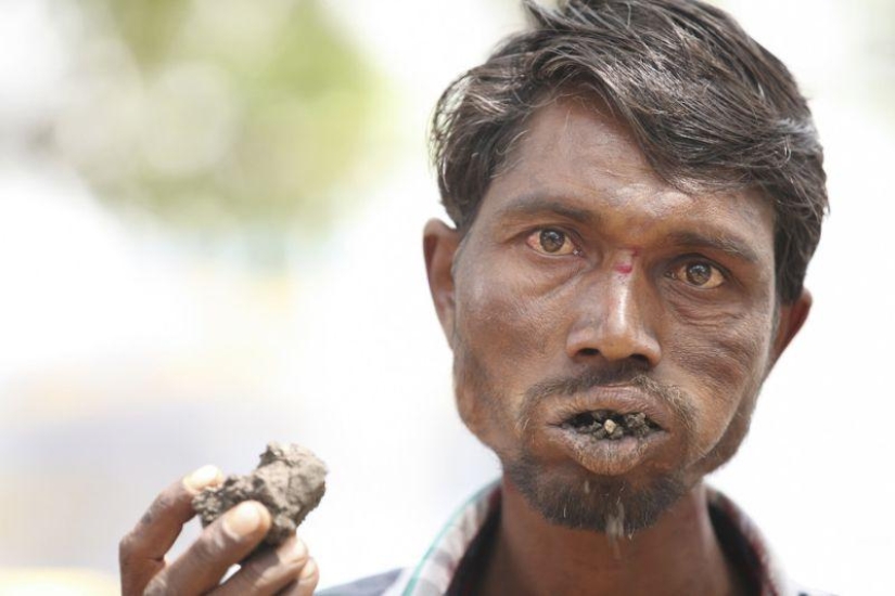 Indian man eats bricks and stones for 20 years