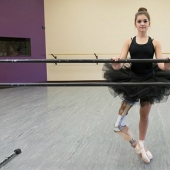 Inspiring example: a girl with a prosthetic leg became a wonderful dancer