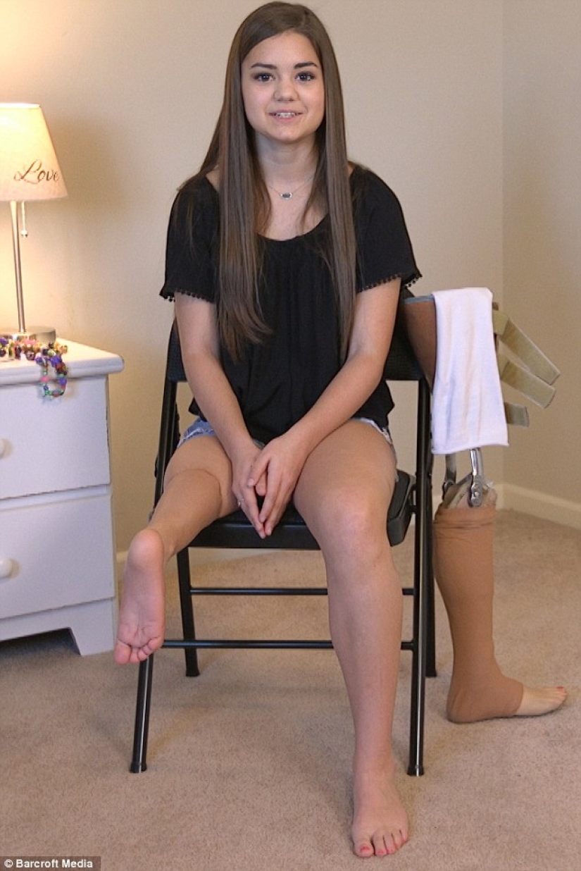 Inspiring example: a girl with a prosthetic leg became a wonderful dancer Inspiring example: a girl with a prosthetic leg became a wonderful dancer