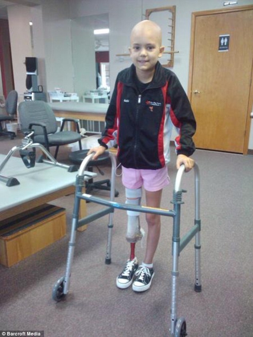 Inspiring example: a girl with a prosthetic leg became a wonderful dancer Inspiring example: a girl with a prosthetic leg became a wonderful dancer