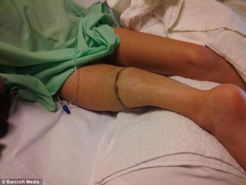 Inspiring example: a girl with a prosthetic leg became a wonderful dancer Inspiring example: a girl with a prosthetic leg became a wonderful dancer