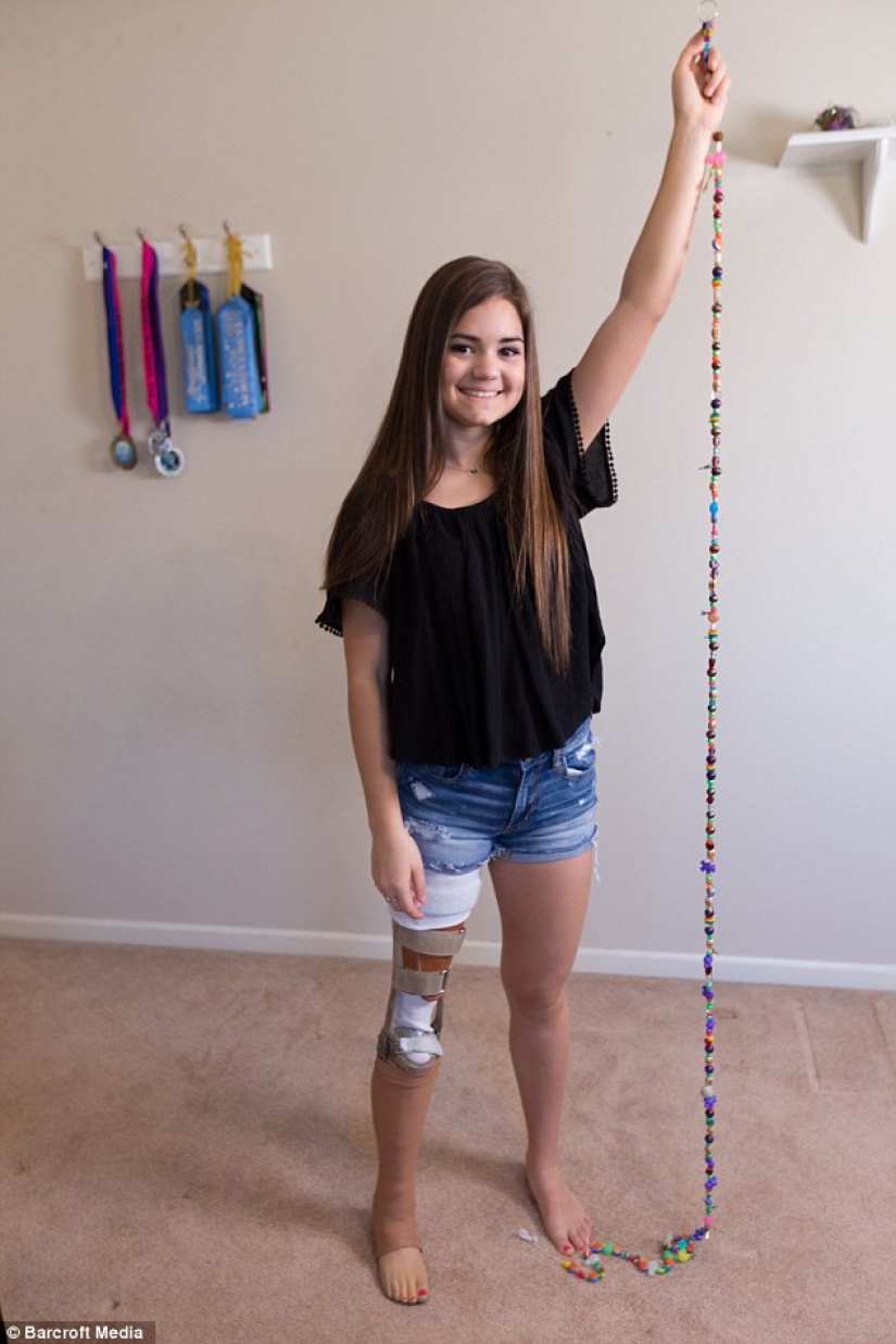 Inspiring example: a girl with a prosthetic leg became a wonderful dancer Inspiring example: a girl with a prosthetic leg became a wonderful dancer