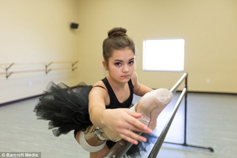 Inspiring example: a girl with a prosthetic leg became a wonderful dancer Inspiring example: a girl with a prosthetic leg became a wonderful dancer