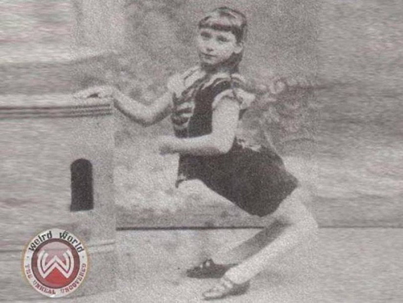 It's hard to believe, but these 5 people with anomalies really existed!