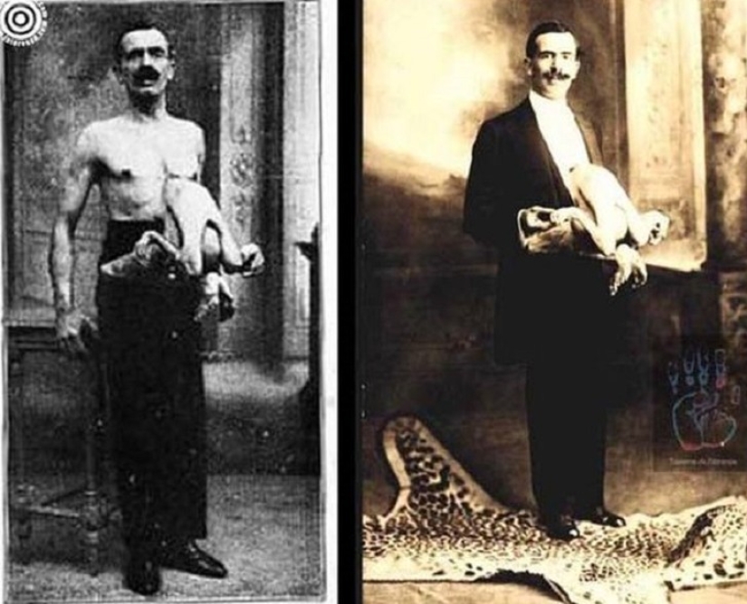 It's hard to believe, but these 5 people with anomalies really existed!