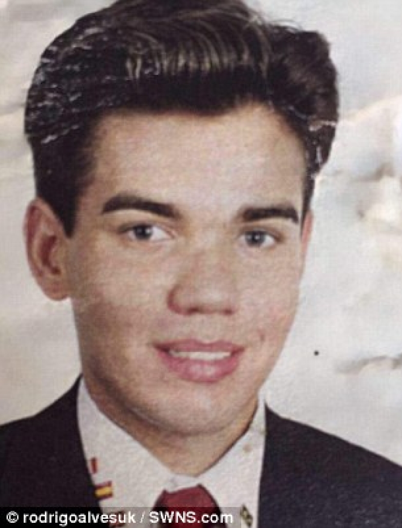 Ken dejó de someterse a una cirugía plástica cuando casi pierde la nariz después de 43 operaciones