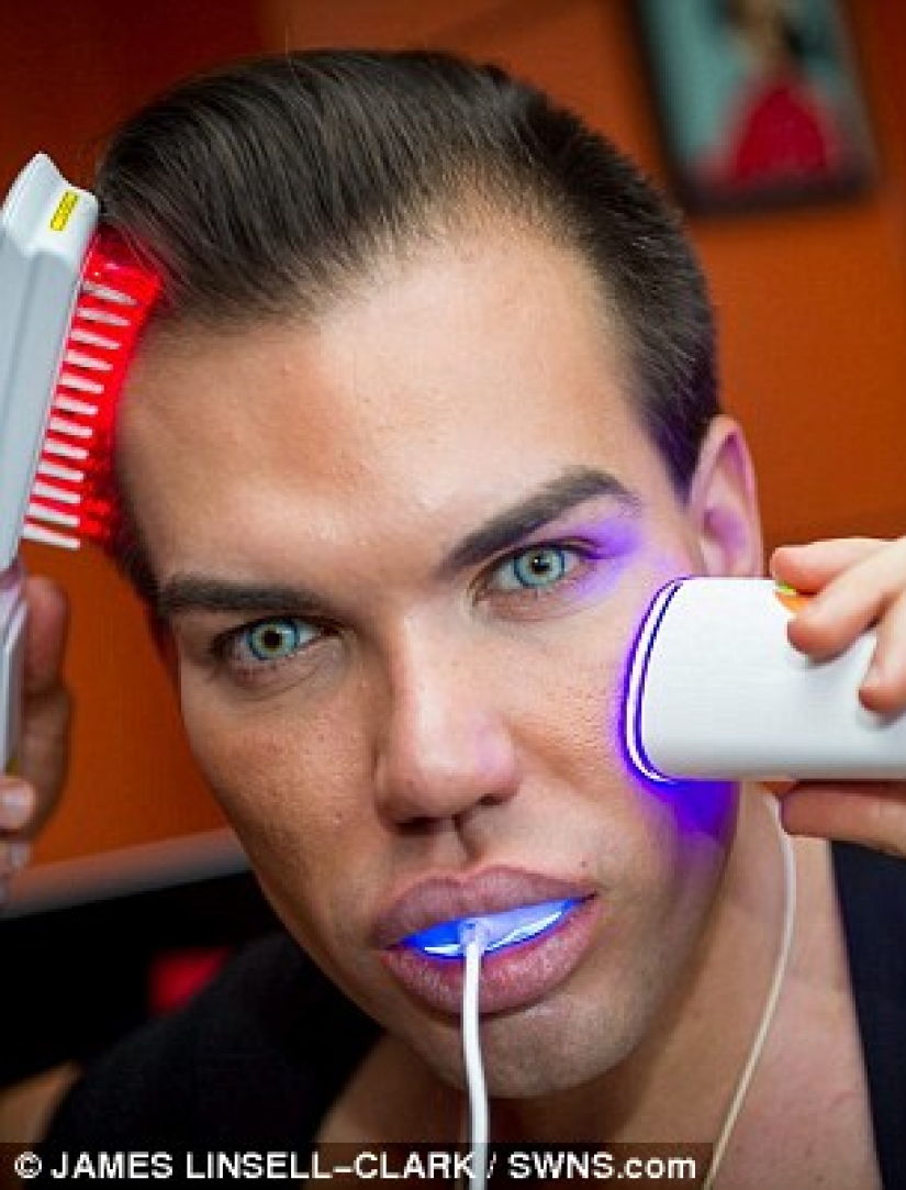 Ken dejó de someterse a una cirugía plástica cuando casi pierde la nariz después de 43 operaciones