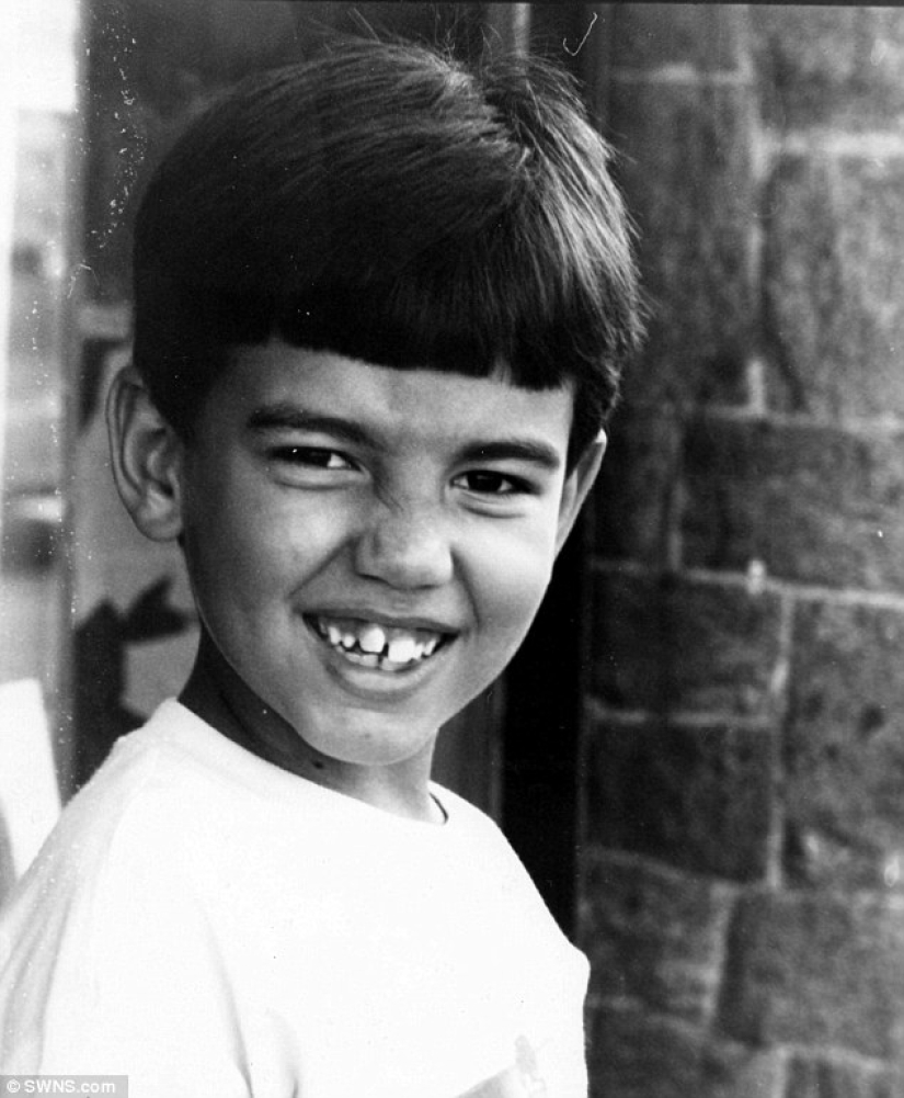 Ken dejó de someterse a una cirugía plástica cuando casi pierde la nariz después de 43 operaciones