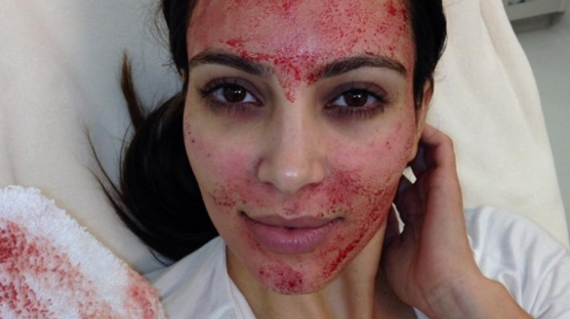 La belleza requiere sacrificio: qué hacen las estrellas en busca de la eterna juventud La belleza requiere sacrificio: qué hacen las estrellas en busca de la eterna juventud