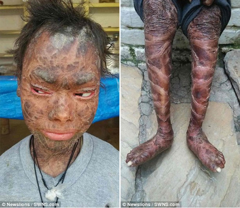 La chica serpiente se quita la piel cada seis semanas La chica serpiente se quita la piel cada seis semanas