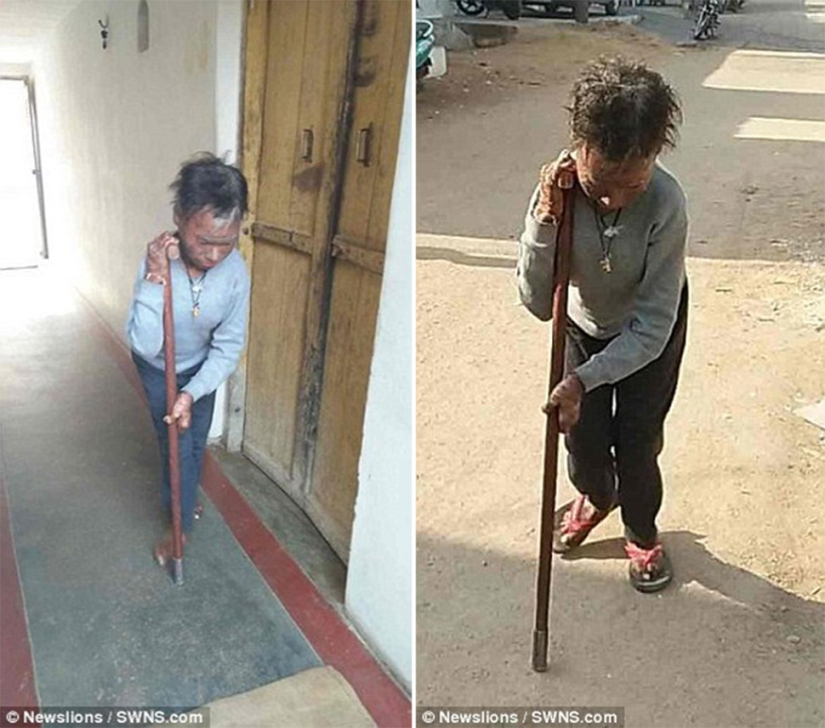 La chica serpiente se quita la piel cada seis semanas La chica serpiente se quita la piel cada seis semanas