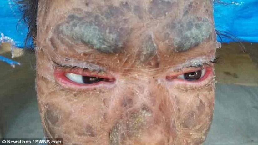 La chica serpiente se quita la piel cada seis semanas La chica serpiente se quita la piel cada seis semanas