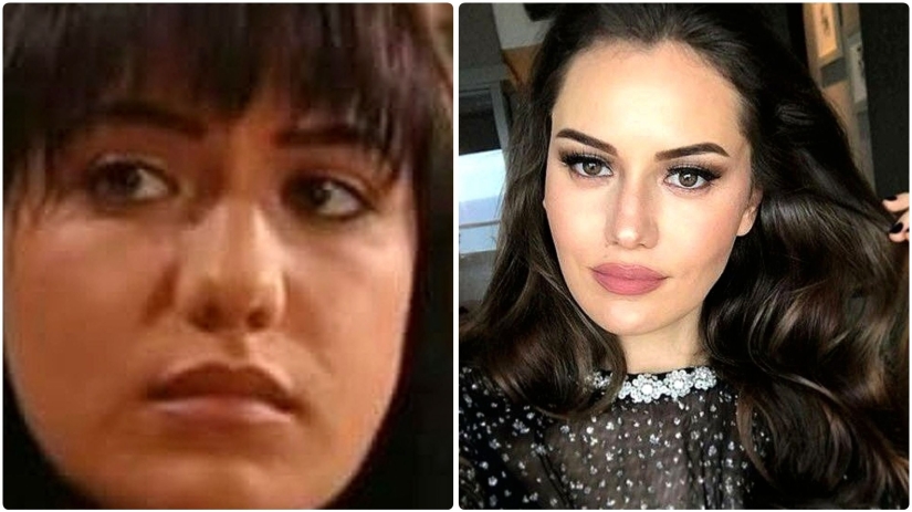 La esposa de Burak Ozchivit realizó más de 14 operaciones: ¿cómo se veía antes de la estética?