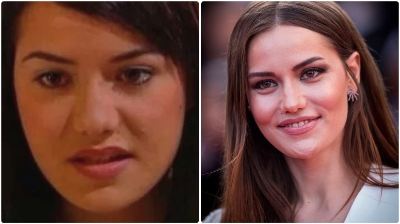 La esposa de Burak Ozchivit realizó más de 14 operaciones: ¿cómo se veía antes de la estética?