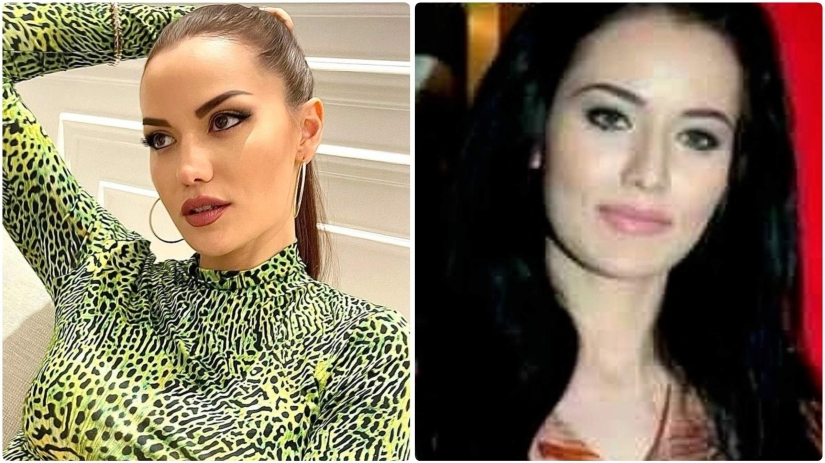 La esposa de Burak Ozchivit realizó más de 14 operaciones: ¿cómo se veía antes de la estética?