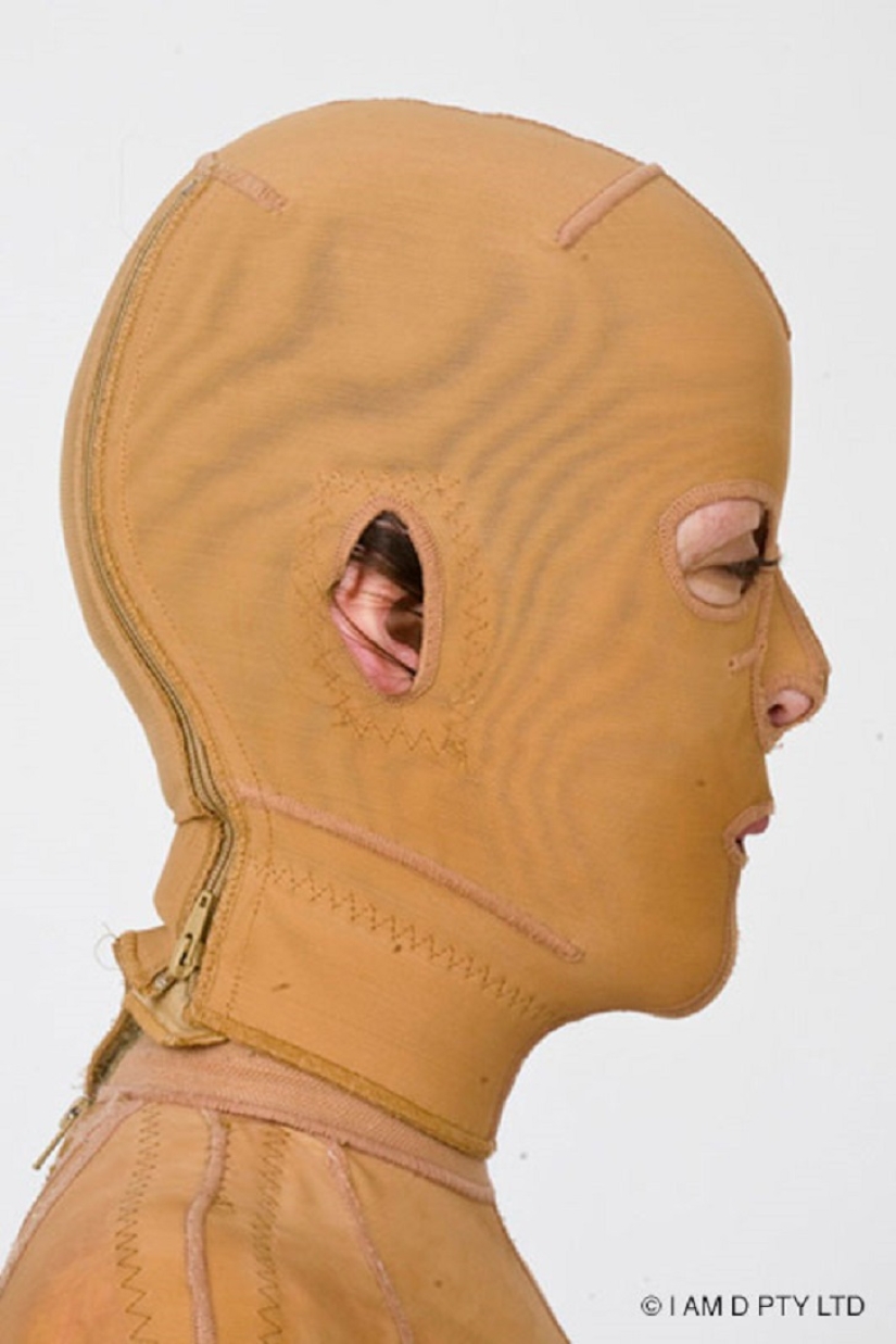 La mujer australiana que alguna vez estuvo a punto de quemarse viva finalmente se quitó la máscara La mujer australiana que alguna vez estuvo a punto de quemarse viva finalmente se quitó la máscara