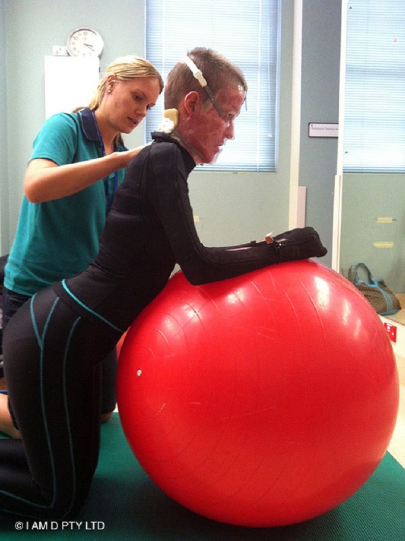 La mujer australiana que alguna vez estuvo a punto de quemarse viva finalmente se quitó la máscara La mujer australiana que alguna vez estuvo a punto de quemarse viva finalmente se quitó la máscara