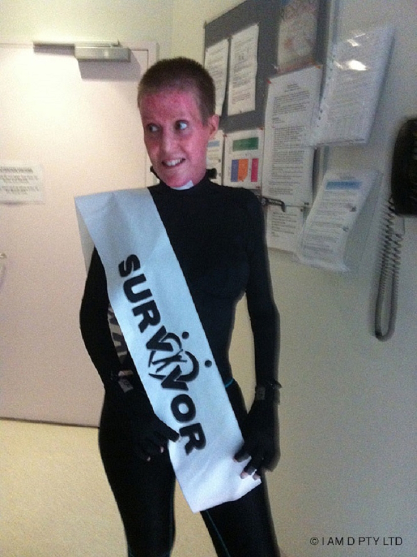 La mujer australiana que alguna vez estuvo a punto de quemarse viva finalmente se quitó la máscara La mujer australiana que alguna vez estuvo a punto de quemarse viva finalmente se quitó la máscara