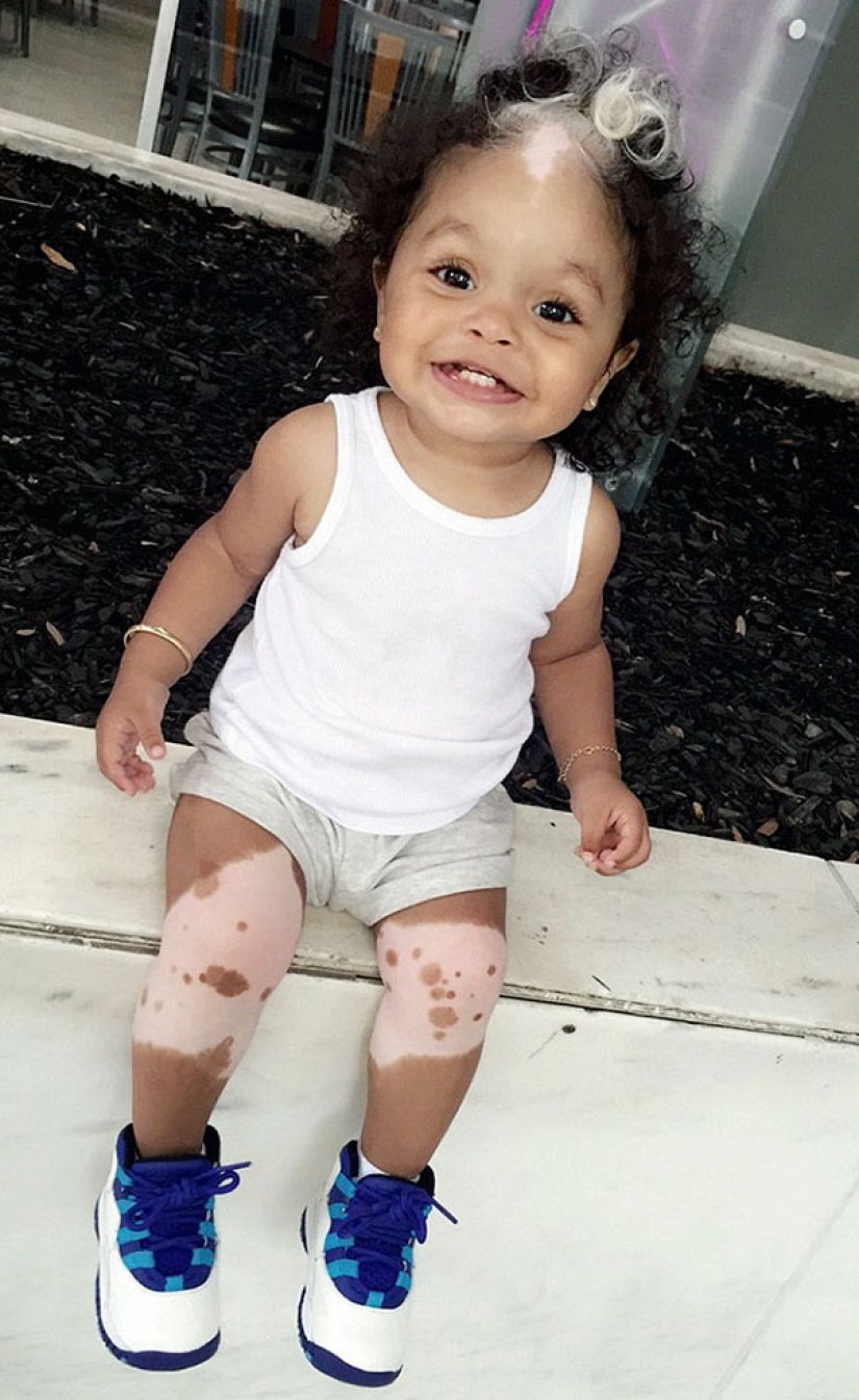 La niña nació con flequillo blanco, exactamente igual que su madre, abuela y bisabuela La niña nació con flequillo blanco, exactamente igual que su madre, abuela y bisabuela