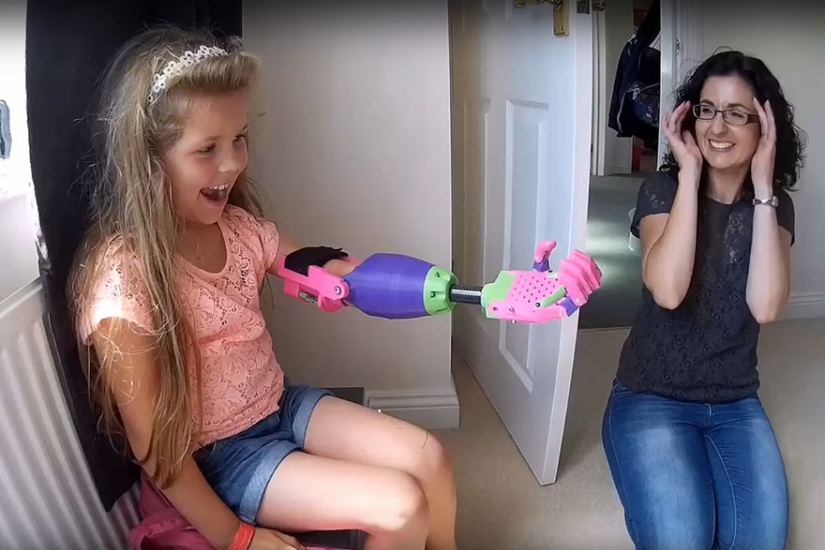 La niña recibió una prótesis 3D de un diseñador que tampoco tiene brazo La niña recibió una prótesis 3D de un diseñador que tampoco tiene brazo