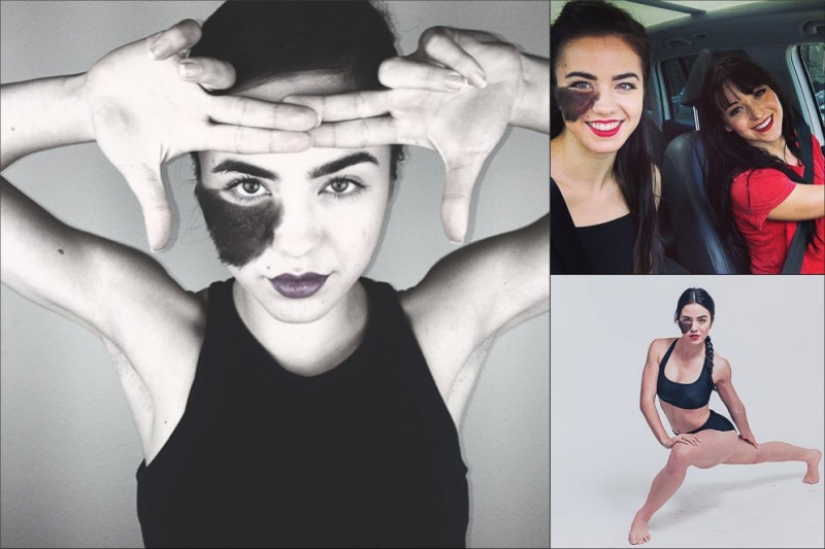 La niña se niega a quitarse la marca de nacimiento, considerándola su punto culminante. La niña se niega a quitarse la marca de nacimiento, considerándola su punto culminante.