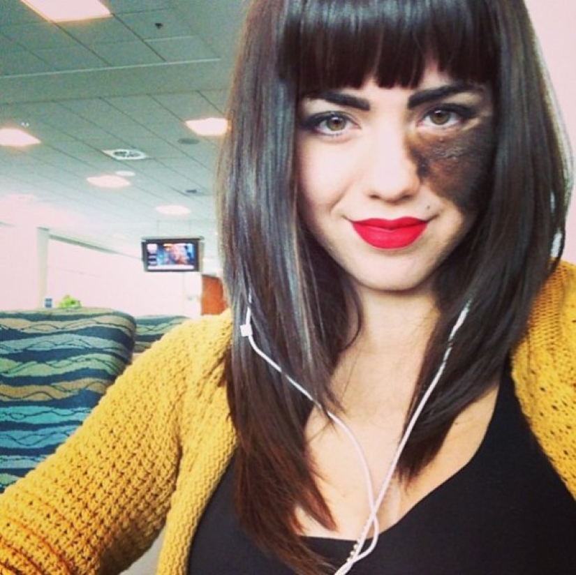 La niña se niega a quitarse la marca de nacimiento, considerándola su punto culminante. La niña se niega a quitarse la marca de nacimiento, considerándola su punto culminante.