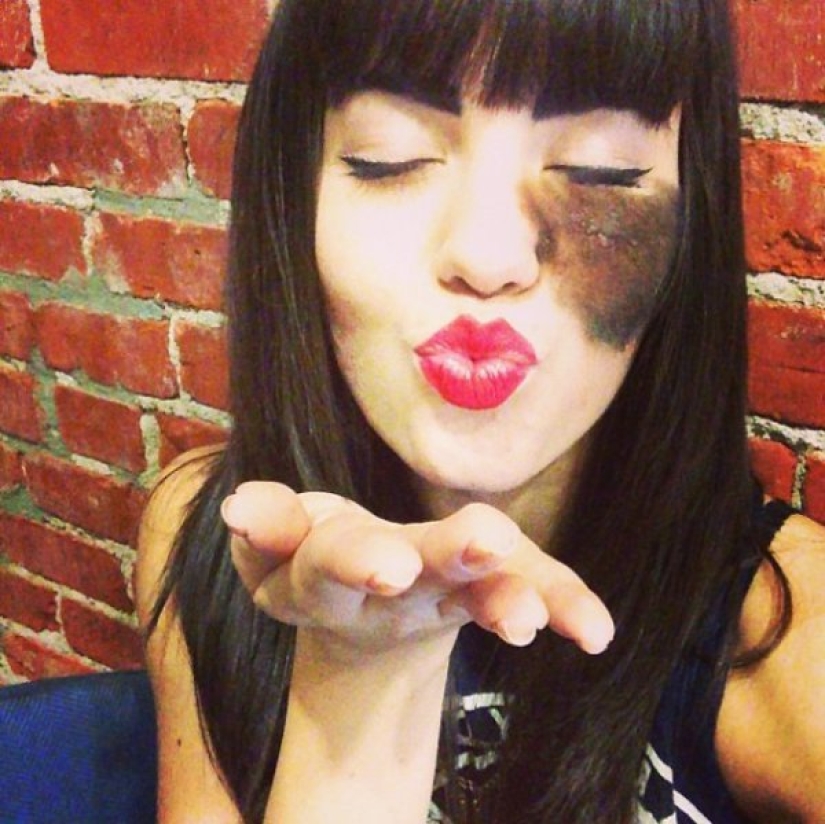 La niña se niega a quitarse la marca de nacimiento, considerándola su punto culminante. La niña se niega a quitarse la marca de nacimiento, considerándola su punto culminante.