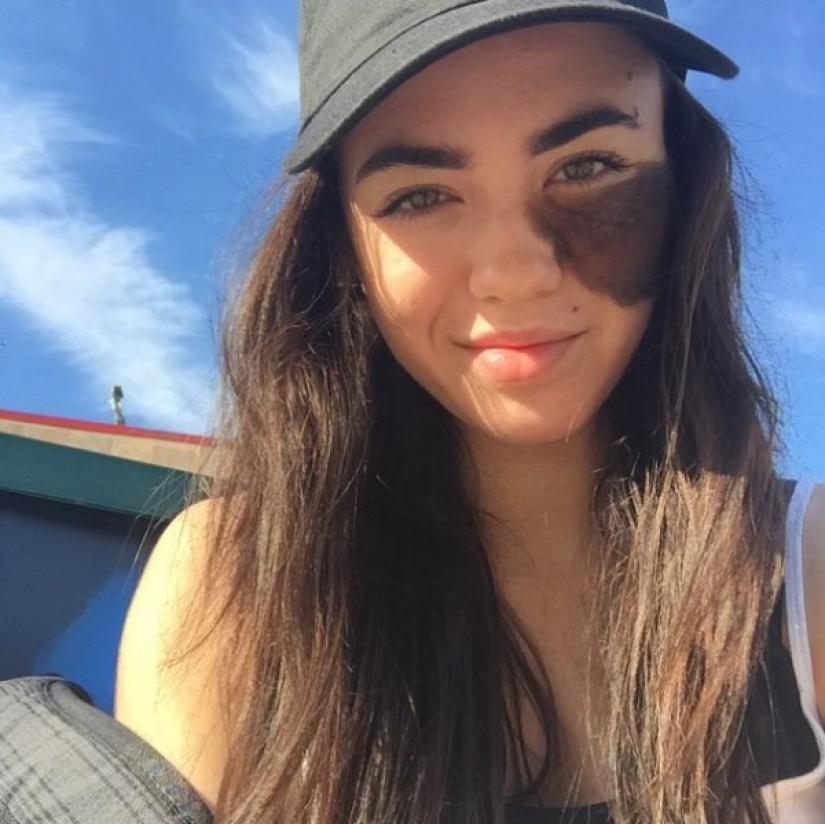 La niña se niega a quitarse la marca de nacimiento, considerándola su punto culminante. La niña se niega a quitarse la marca de nacimiento, considerándola su punto culminante.