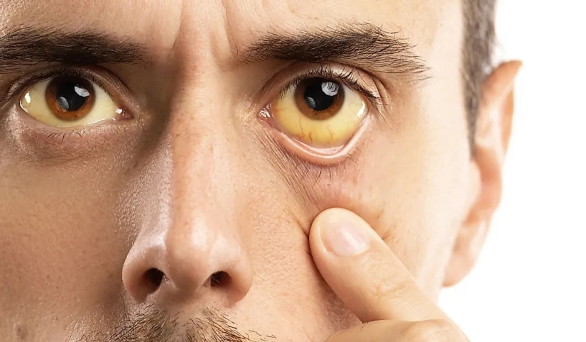 La población mundial por color de ojos