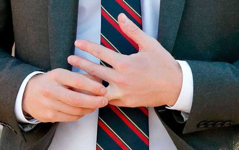 La pobreza se escribe en la cara: 10 señales que dan a conocer una situación económica