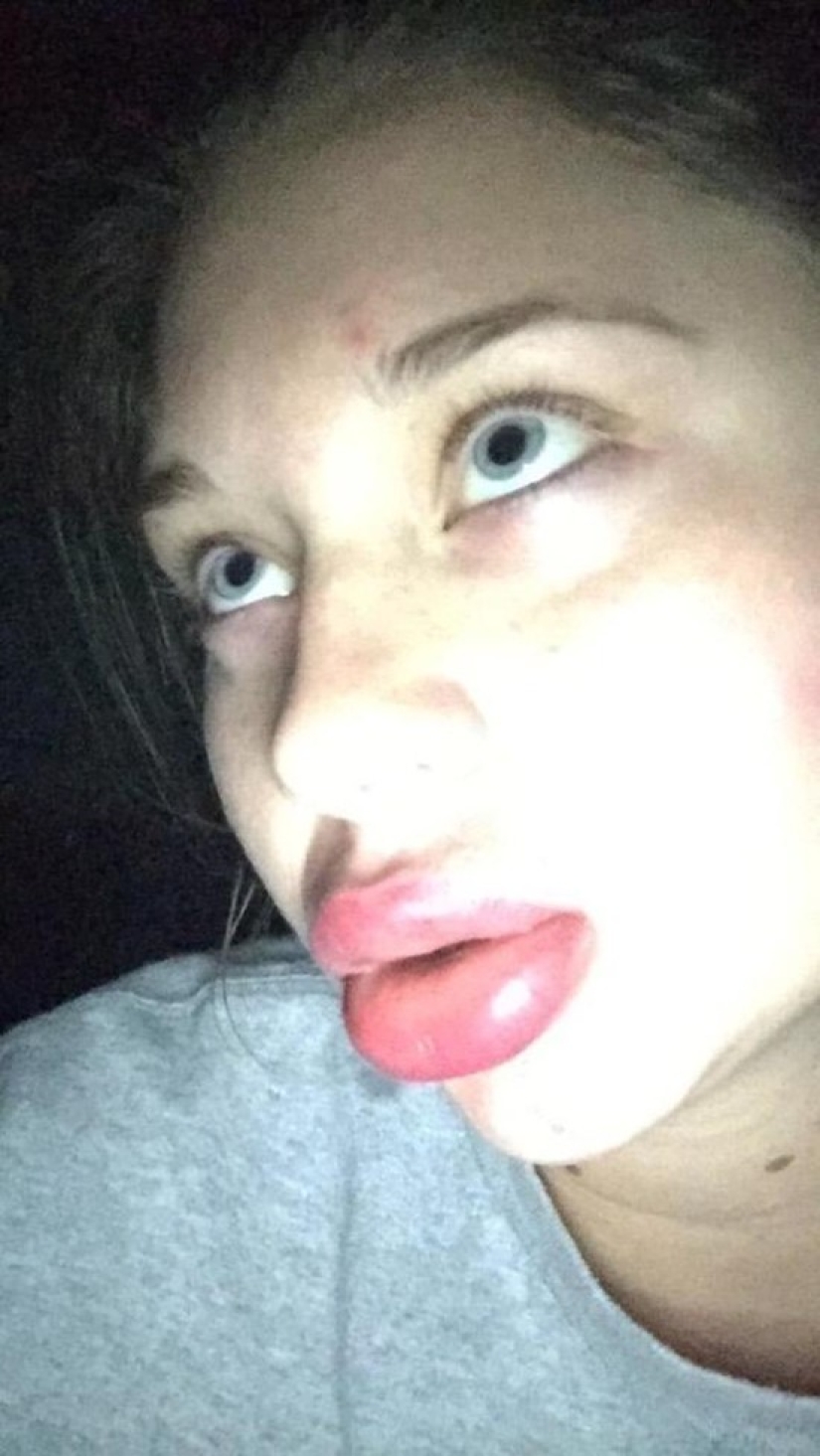 Las chicas tratan de hacer que sus labios se llenen como una estrella de televisión. no sale muy... Las chicas tratan de hacer que sus labios se llenen como una estrella de televisión. no sale muy...