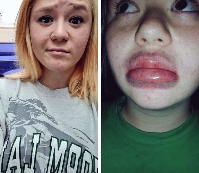 Las chicas tratan de hacer que sus labios se llenen como una estrella de televisión. no sale muy... Las chicas tratan de hacer que sus labios se llenen como una estrella de televisión. no sale muy...