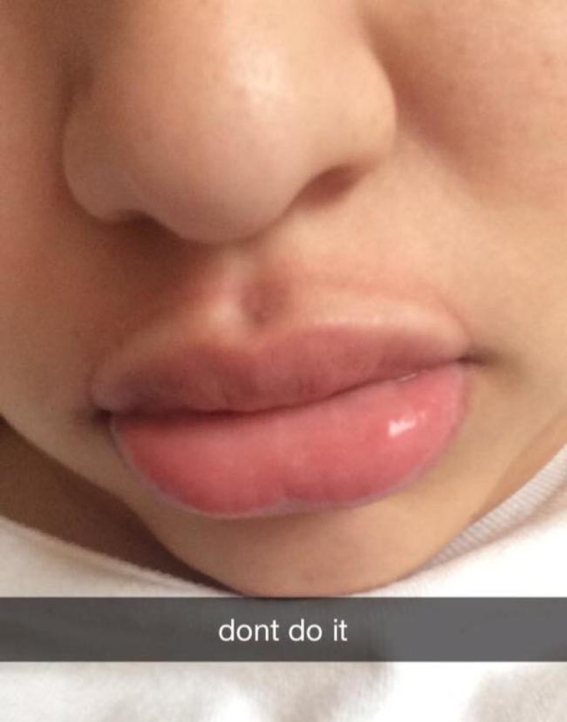 Las chicas tratan de hacer que sus labios se llenen como una estrella de televisión. no sale muy... Las chicas tratan de hacer que sus labios se llenen como una estrella de televisión. no sale muy...