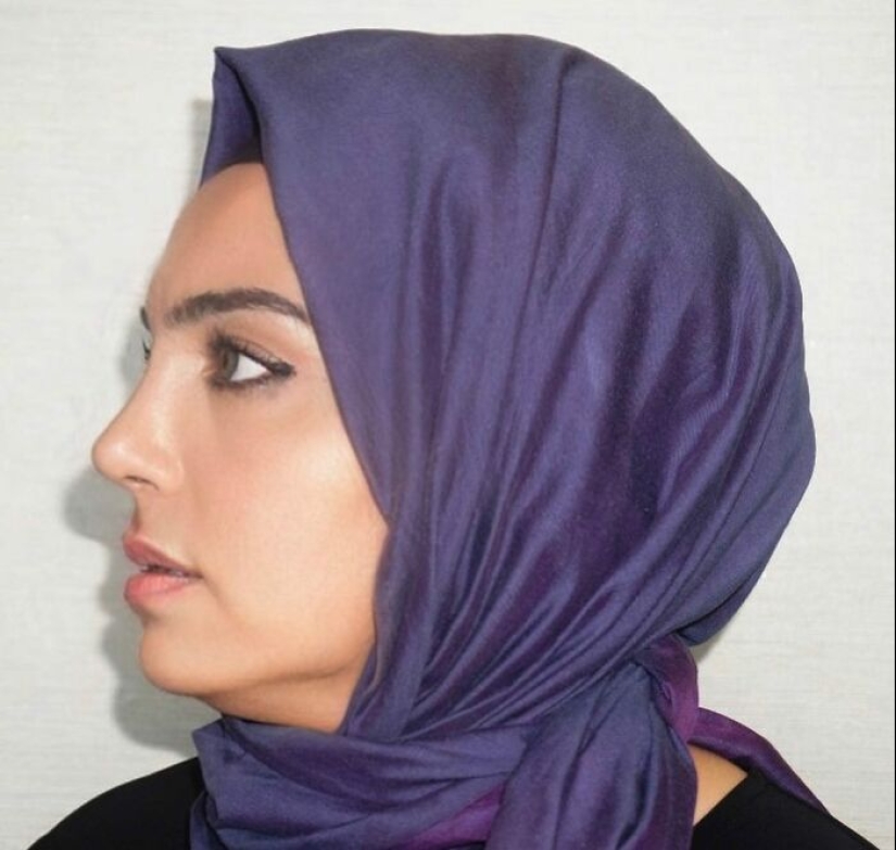 Las fotos de antes y después de la clínica turca de cirugía plástica han dejado a la gente desconcertada