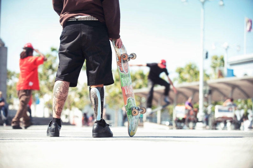 ¡Las prótesis también pueden ser elegantes y con estilo!