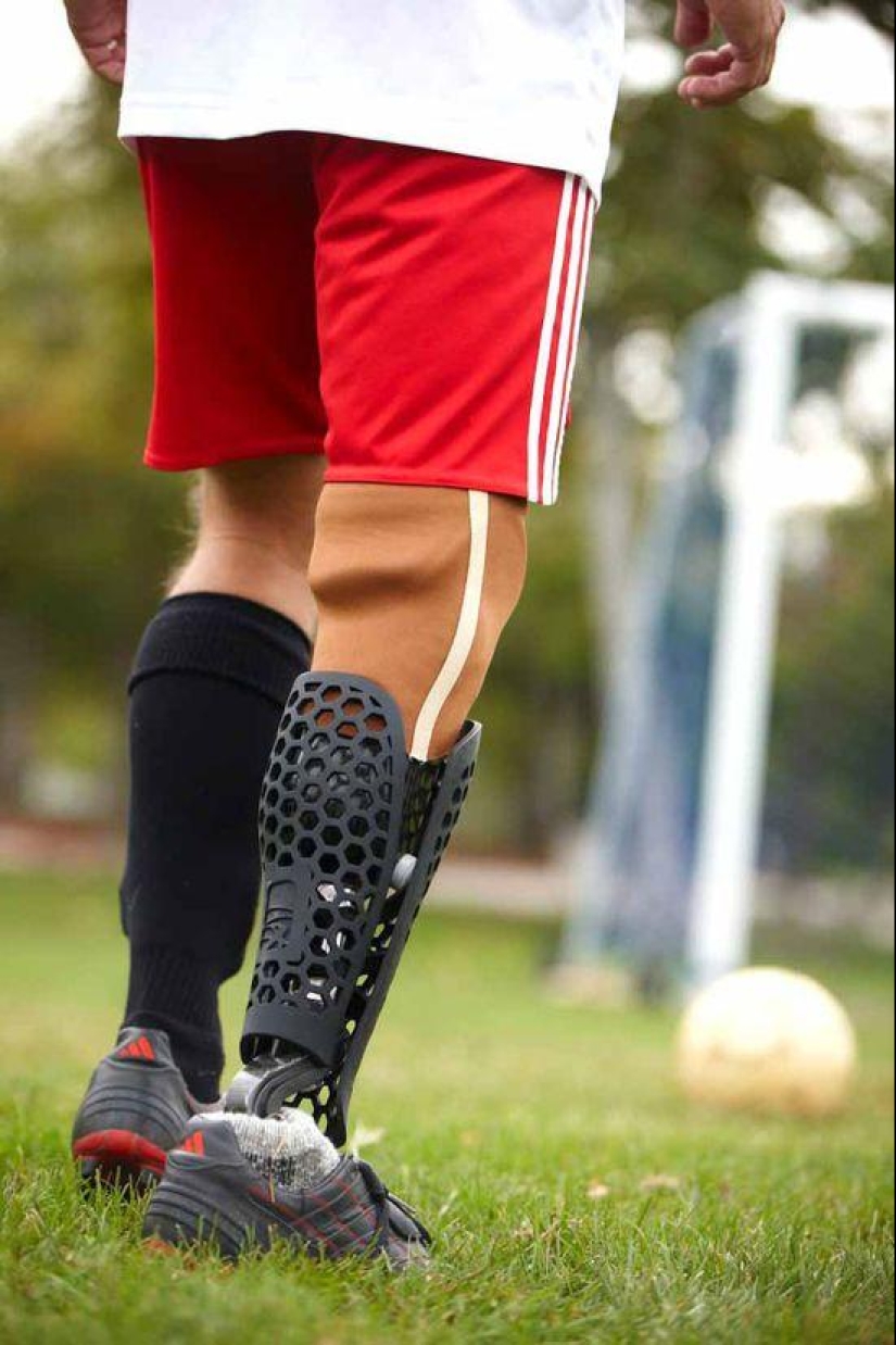 ¡Las prótesis también pueden ser elegantes y con estilo!