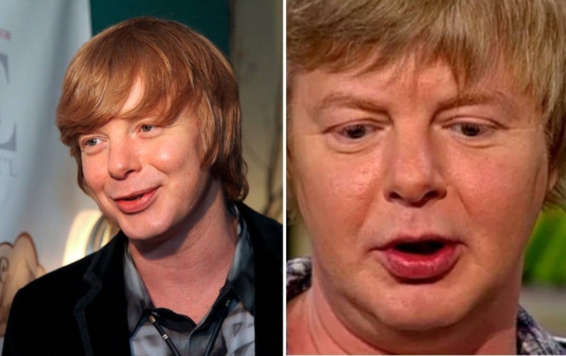 Launched themselves: 10 stars whose appearance is now far from ideal