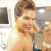 Live Ken stopped with plastic surgery when he almost lost his nose after 43 operations