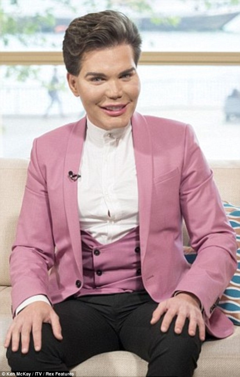 Live Ken stopped with plastic surgery when he almost lost his nose after 43 operations