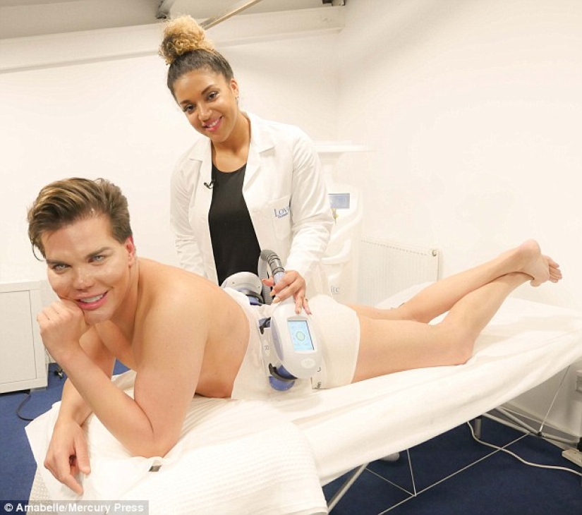 Live Ken stopped with plastic surgery when he almost lost his nose after 43 operations