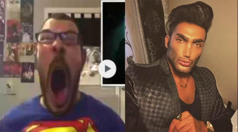 Los pómulos de Angelina Jolie: cómo se ven los hombres antes y después de las "inyecciones de belleza" Los pómulos de Angelina Jolie: cómo se ven los hombres antes y después de las "inyecciones de belleza"