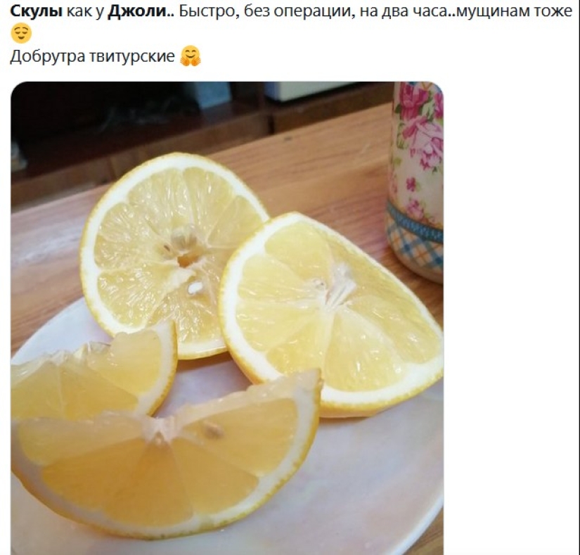 Los pómulos de Angelina Jolie: cómo se ven los hombres antes y después de las "inyecciones de belleza" Los pómulos de Angelina Jolie: cómo se ven los hombres antes y después de las "inyecciones de belleza"