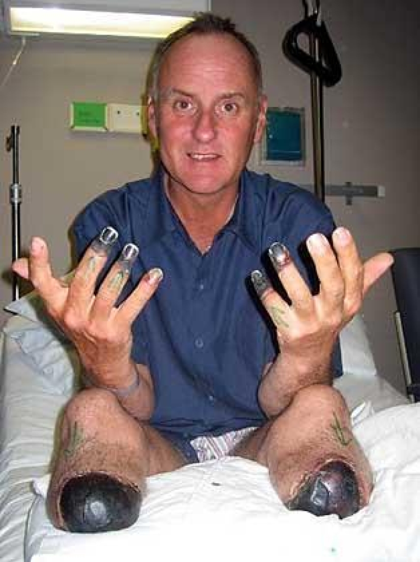 Mark Inglis: first climber to summit Everest without legs Mark Inglis: first climber to summit Everest without legs