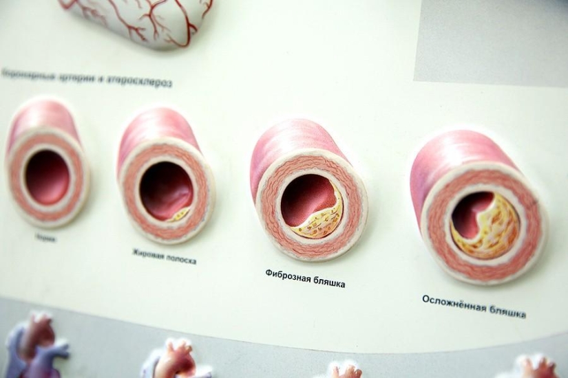 Matters of the Heart, or Operation Without Cuts Matters of the Heart, or Operation Without Cuts