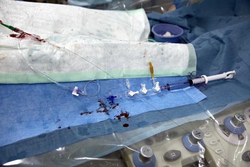 Matters of the Heart, or Operation Without Cuts Matters of the Heart, or Operation Without Cuts